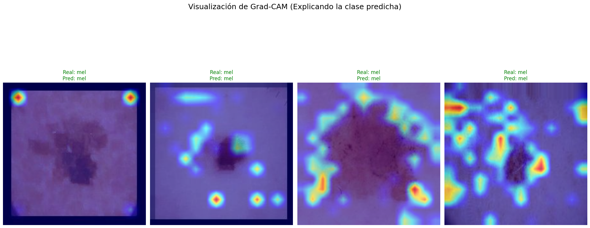 Mapas de activación Grad-CAM sobre lesiones cutáneas
